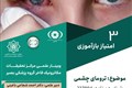 ترومای چشمی