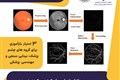 پردازش تصاویر شبکیه