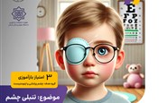 تنبلی چشم (Amblyopia)